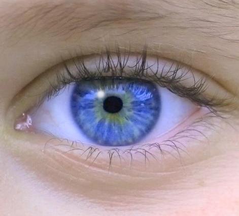una niña que quedo ciega recupera la vision con la ayuda de la cirugia