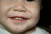 3690Cómo prevenir las caries (II)