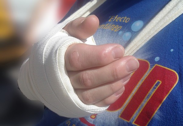 Consecuencias de las fracturas en la niñez