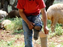 Los niños con prótesis serán de los más afectados por la ley de copago