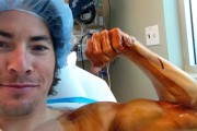 hayden operacion 2