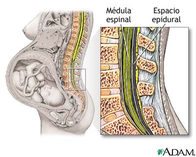El tratamiento de la hernia intervertebral en bashkirii
