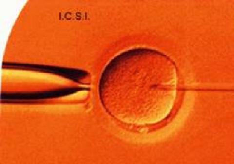 ICSI SIN EMBARAZO icsi sin embarazo: