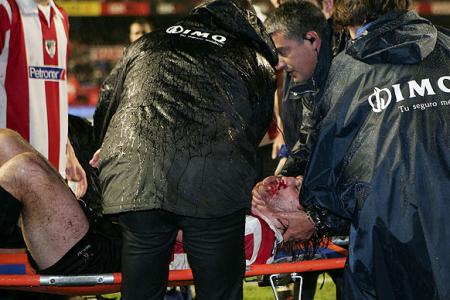 Gurpegi dio el susto en el partido del Athletic de Bilbao frente al Sporting de Gijón