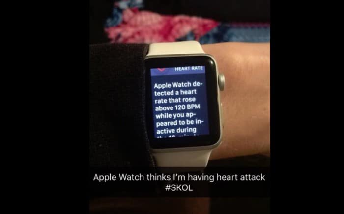 AppleWatchHeartA