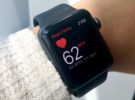 Demandan a Apple por las patentes del sensor cardíaco del Apple Watch