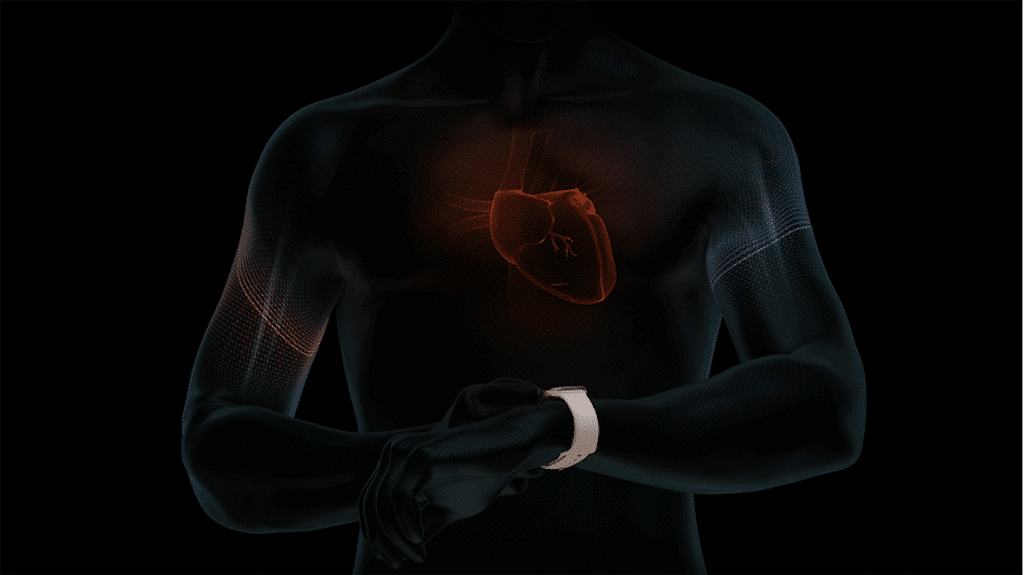 Ecg Apple Watch