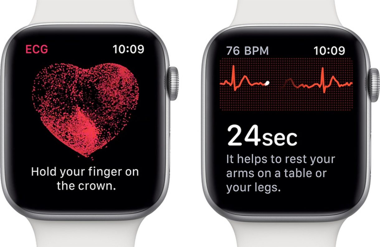 El electrocardiograma en el Apple Watch funciona y convence hasta a los más escépticos