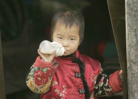 Extrañas piedras de riñón en la infancia china