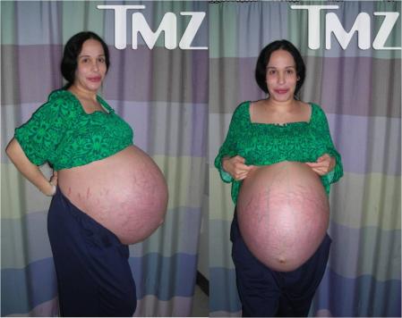 Impresionante barriga para los octillizos