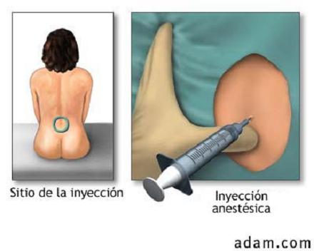 Campaña informativa sobre el control del dolor en el parto en Estados Unidos