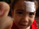 Los niños de 5 a 10 años sufren accidentes por despistes de sus cuidadores