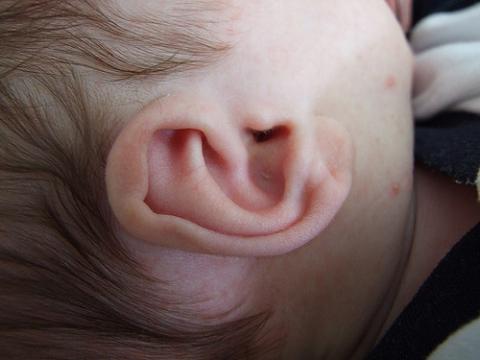 Que hacer si hay un tapón de cera en el oído del bebé