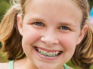 La ortodoncia infantil para corregir dientes mal colocados