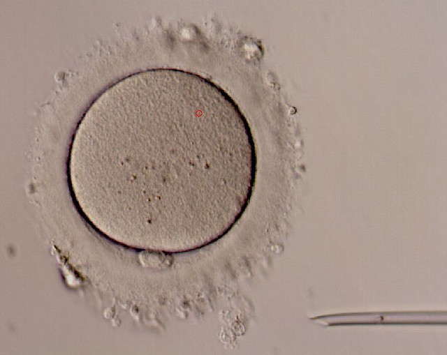 Un nuevo estudio confirma el riesgo de malformaciones tras la fertilización in vitro