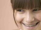 Los niños que respiran por la boca pueden tener problemas dentales