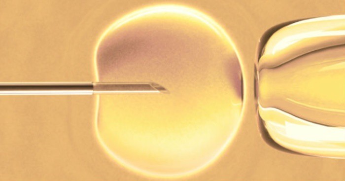 Reproducción asistida: problemas derivados de la fecundación in vitro