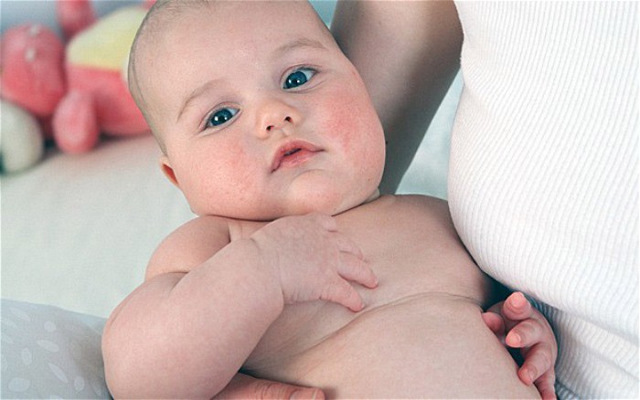 La obesidad infantil podría ser herencia de los padres