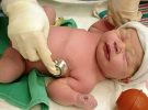 Cuatro mil niños nacen cada año en España con cardiopatías congénitas