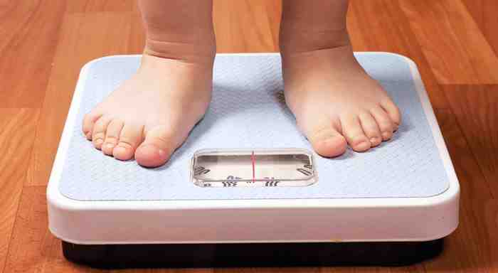 Obesidad y sobrepeso en niños
