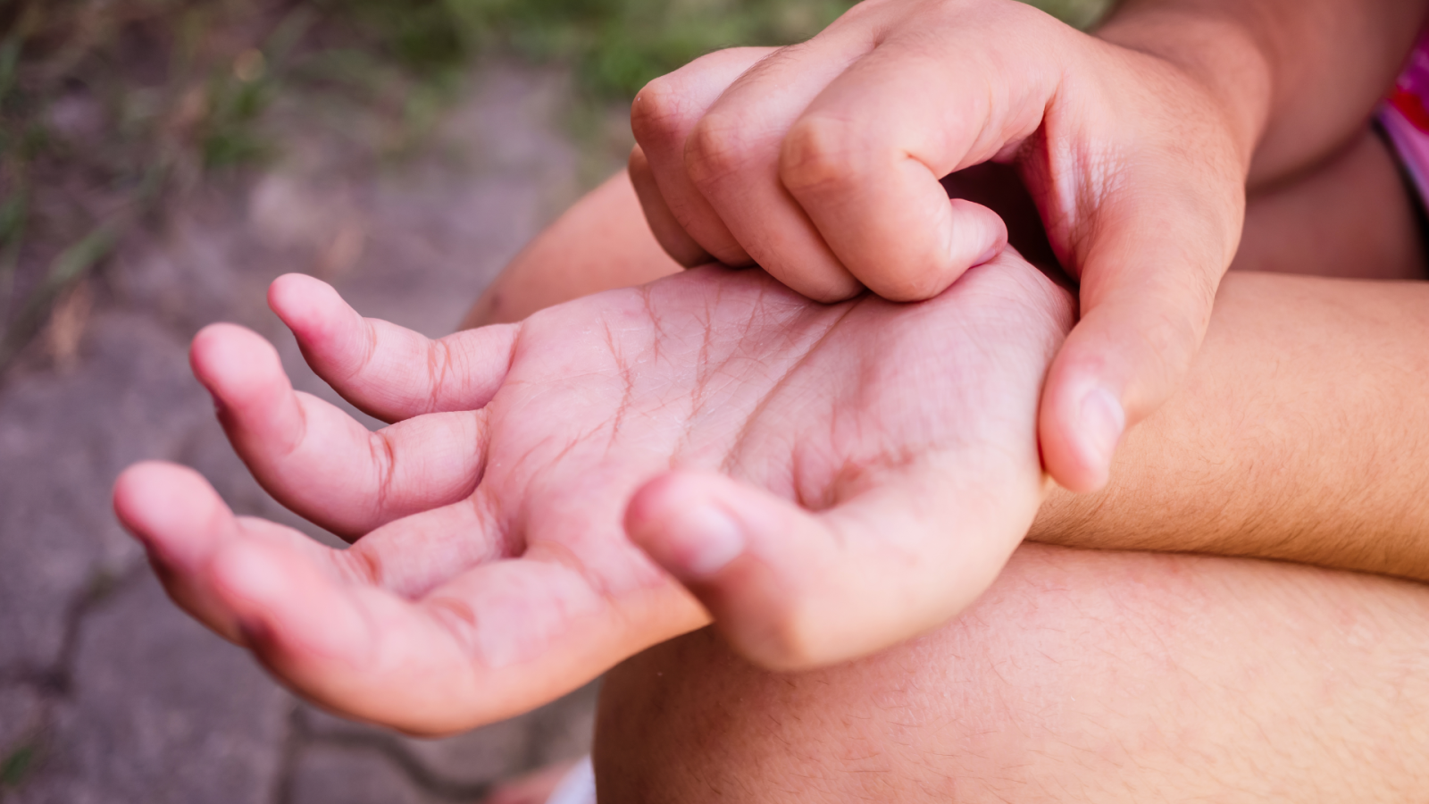 Erupción cutánea en niños causas, tipos y tratamientos
