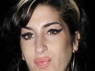 Los nuevos labios de Amy Winehouse