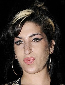 Los nuevos labios de Amy Winehouse