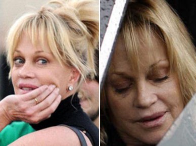 Melanie Griffith operada de cáncer de piel en el rostro