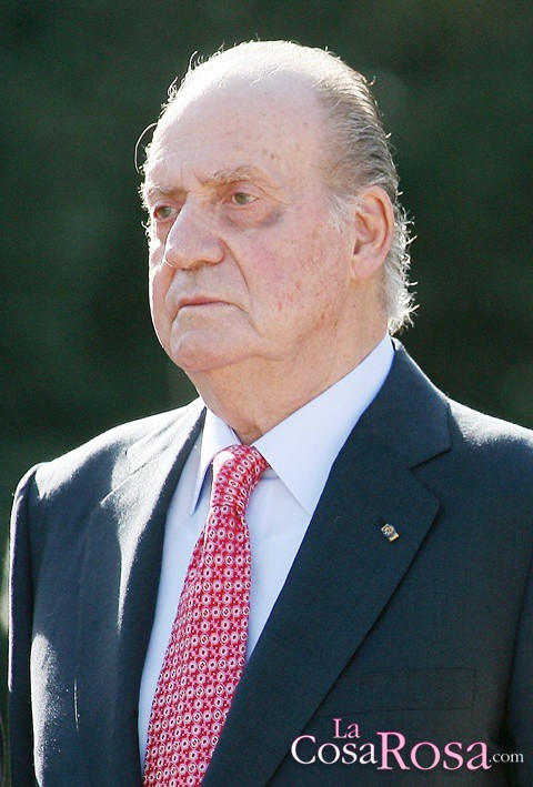 Las ojeras del Rey Don Juan Carlos en el punto de mira