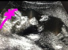 Kevin Jonas y Danielle Delease esperan una niña