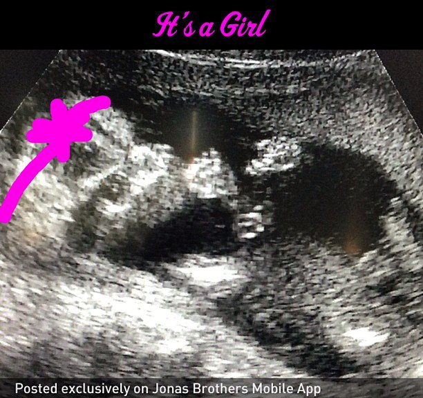 Kevin Jonas y Danielle Delease esperan una niña