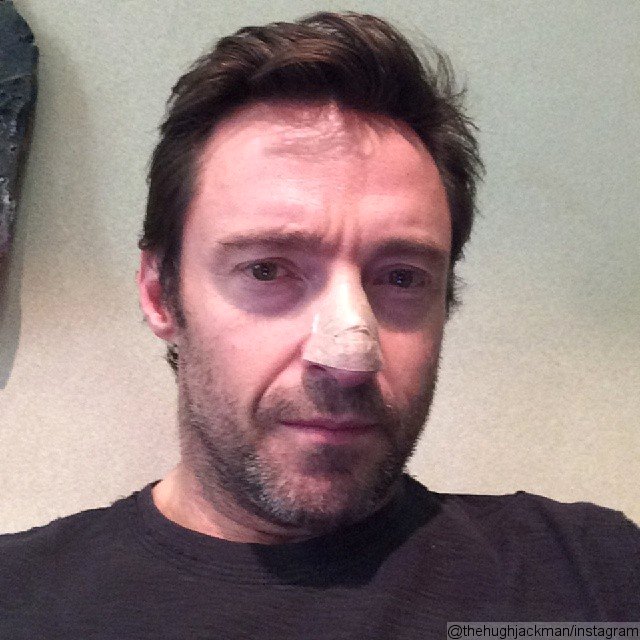 A Hugh Jackman se le diagnostica un cáncer de piel