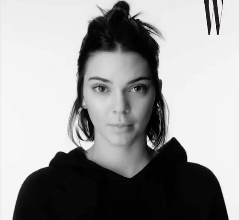 Kendall Jenner, nuevos rumores de cirugía plástica