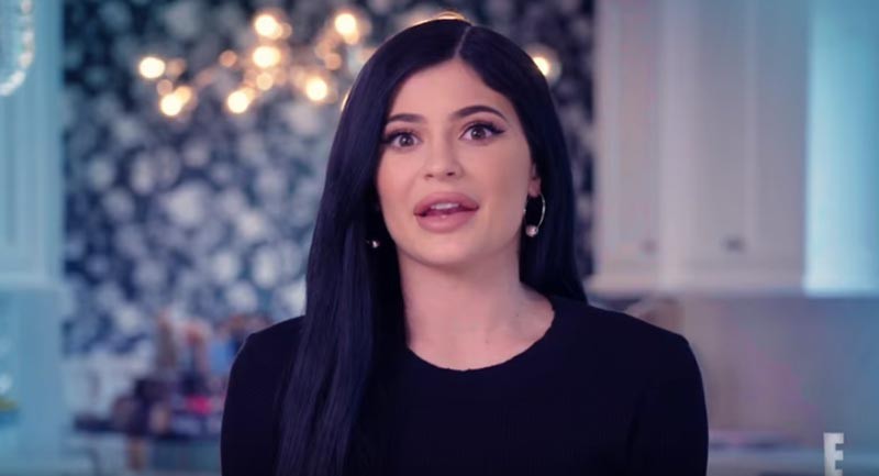 Los labios de Kylie Jenner crean tendencia entre las operaciones de estética