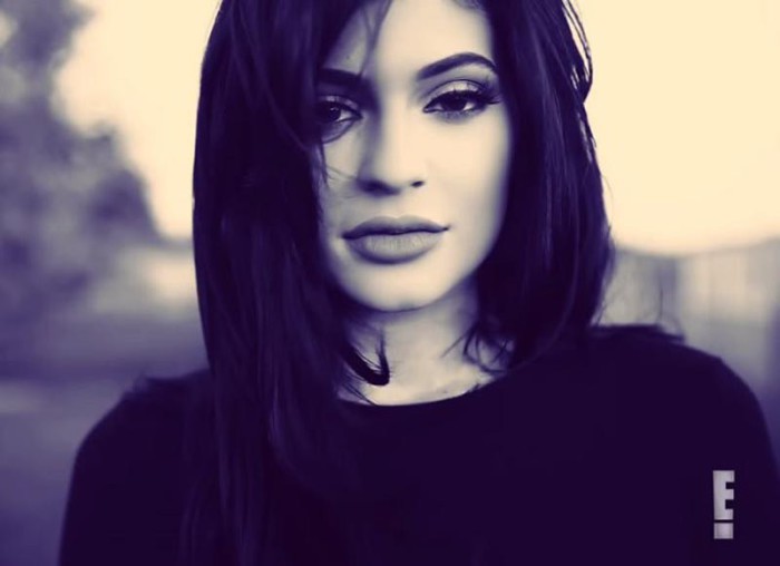 Los labios de Kylie Jenner crean tendencia entre las operaciones de estética