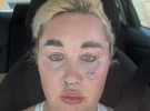 Amanda Bynes muestra su último retoque estético