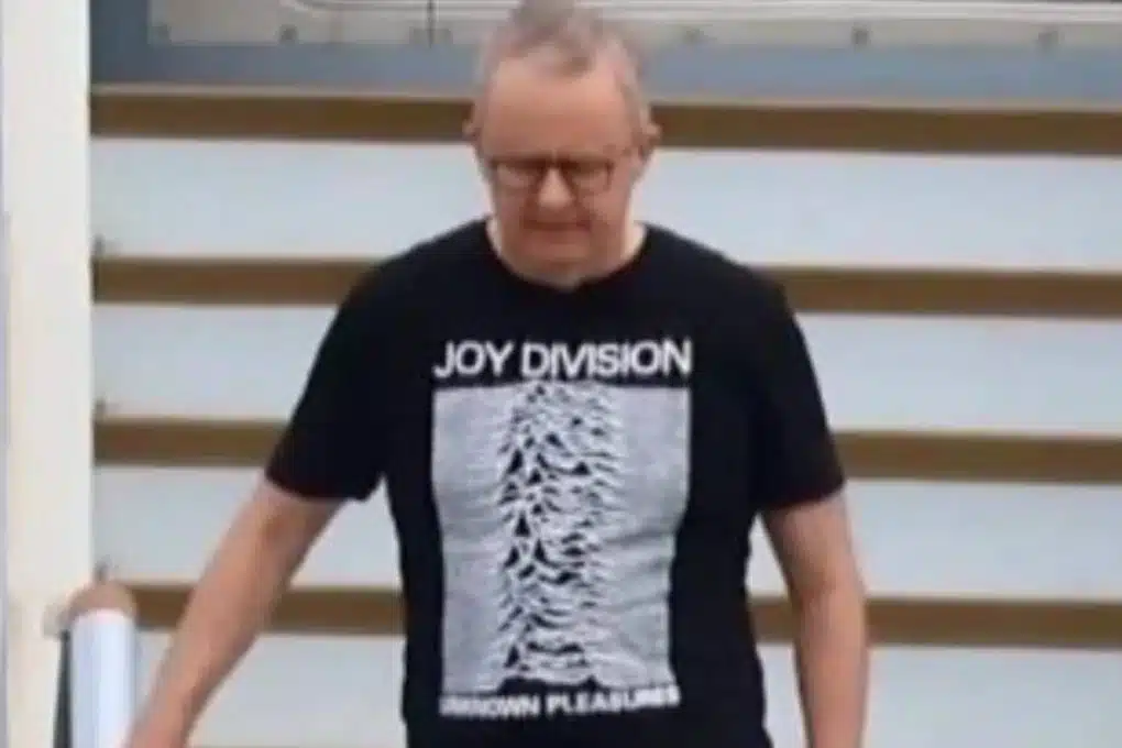 Albanese Joydivision