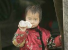 Extrañas piedras de riñón en la infancia china
