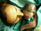 El primer bebé español seleccionado por genética cura a su hermano
