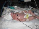 Retiran el respirador a un bebé de dos meses para donar su corazón