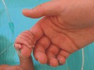 El hospital de Jaén da un paso más en la humanización de la unidad de neonatos