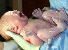 Una segunda cesárea aumenta el riesgo de ingreso del recién nacido