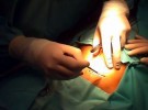 La histerectomía tras una cesárea no es frecuente pero tampoco rara