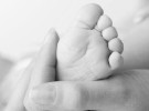 I. Ortopedia, los pies del bebé