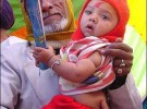Un bebé hindú nace con una cola en la espalda