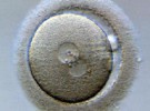 La reproducción asistida podría aumentar el riesgo de malformaciones