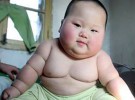 Relacionan, por primera vez, la obesidad infantil con la genética