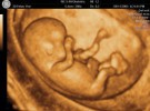 El primer reportaje fotográfico y en video para nuestro bebé