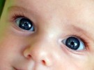 Detectar las cataratas en el recién nacido puede evitar la ceguera