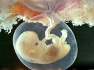 National Geographic: En el vientre materno 4. De la octava a la décima semana